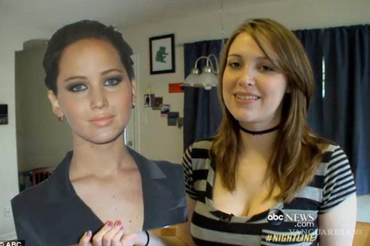 Mujer se somete a cirugía para ser igual a Jenifer Lawrence