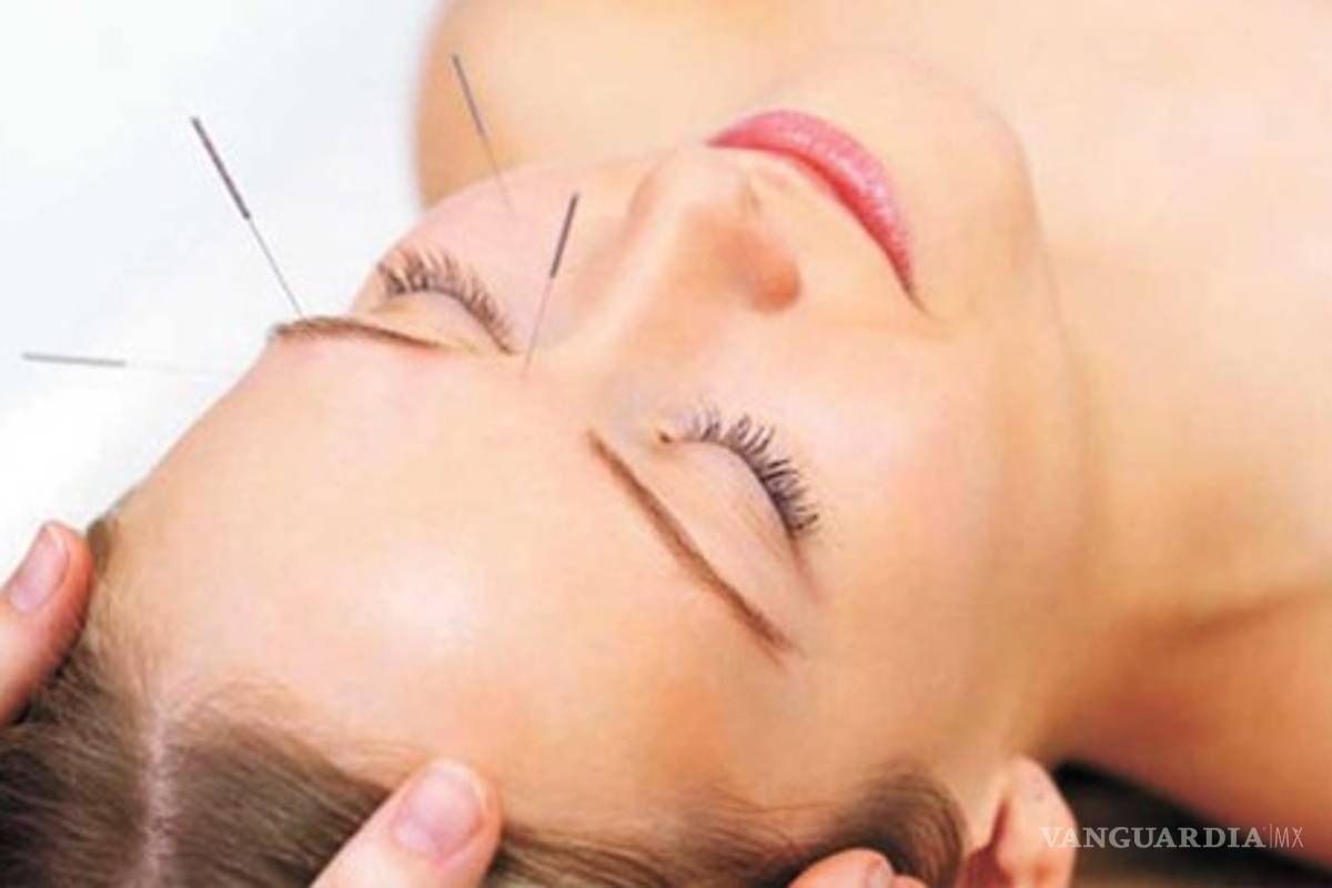Acupuntura, mucho más que una técnica