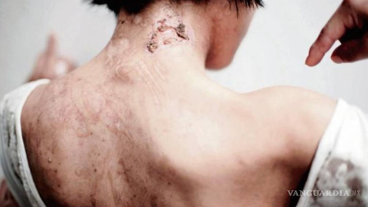 La escalofriante historia de Zunduri, 'la esclava de la tintorería'