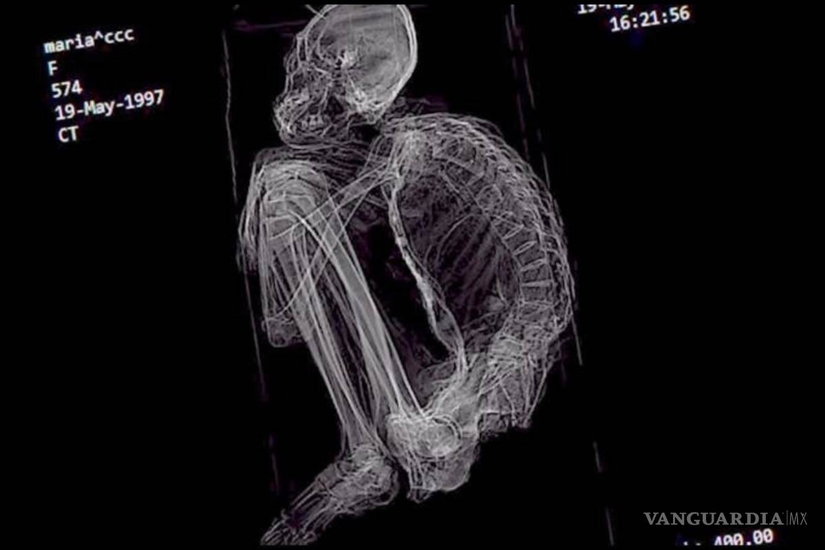 $!Descubren polémica momia "extraterrestre" en Perú