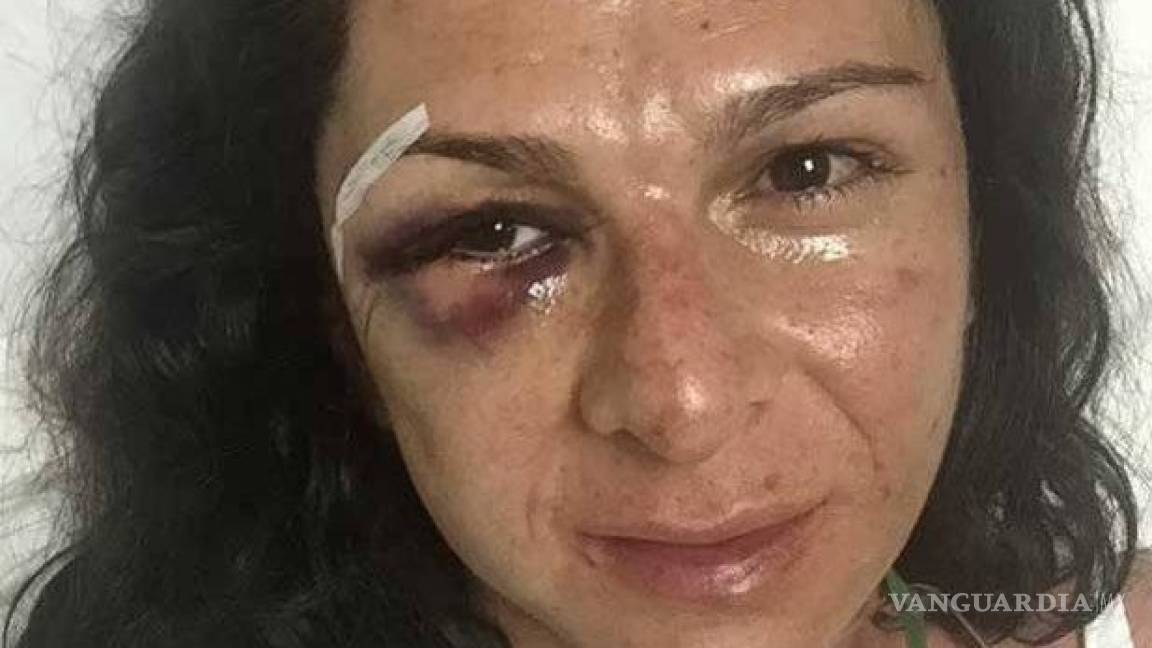Testigos de agresión grabaron videos: Ana Guevara