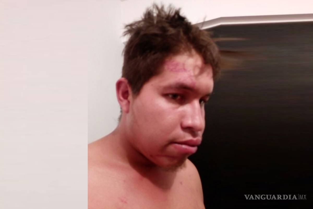 Denuncia joven por tortura a policías de Ramos Arizpe