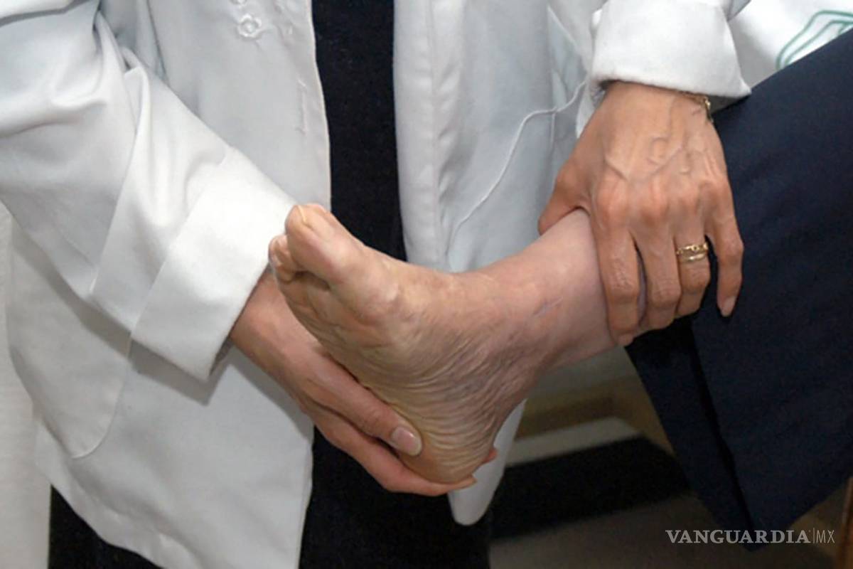 Con nanopartículas de plata tratan científicos mexicanos de forma efectiva el pie diabético