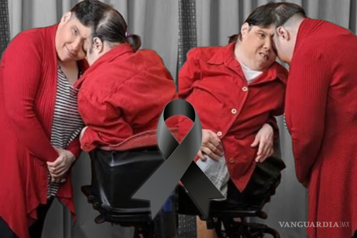 Fallecen los siameses más longevos del mundo, Lori y George Schappell, a los 62 años de edad