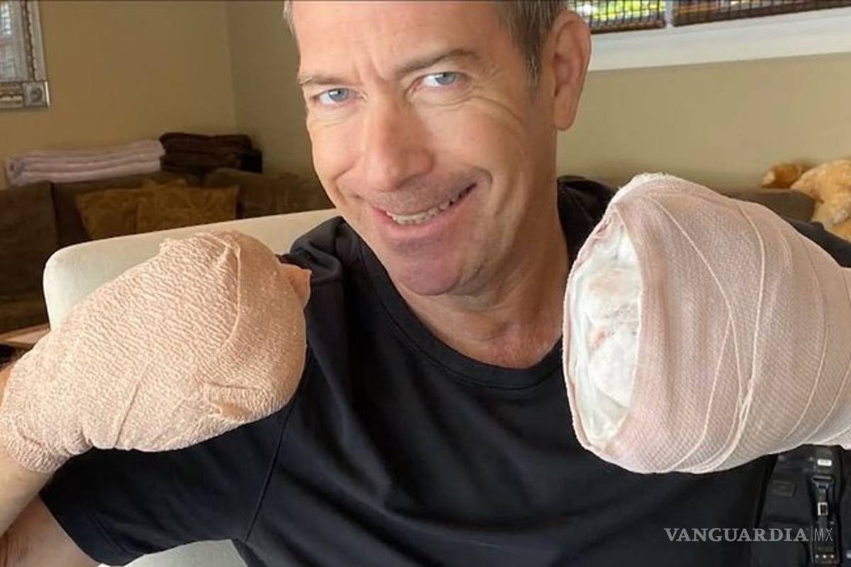 “Ya no tengo dedos. Esto te puede pasar a ti”: sobreviviente del COVID-19