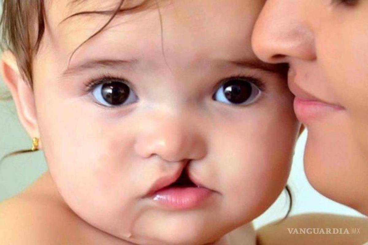 Fundación Shriners PN enfocados en atenciones terapéuticas