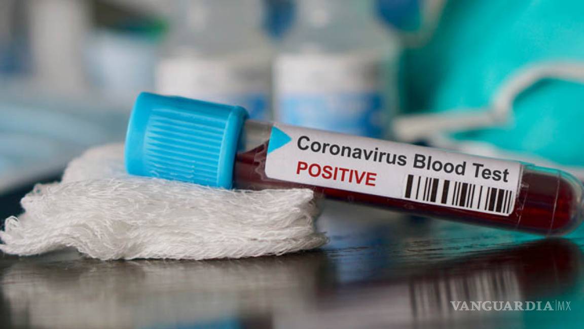 Se suma la Iglesia católica en Saltillo a contingencia por coronavirus