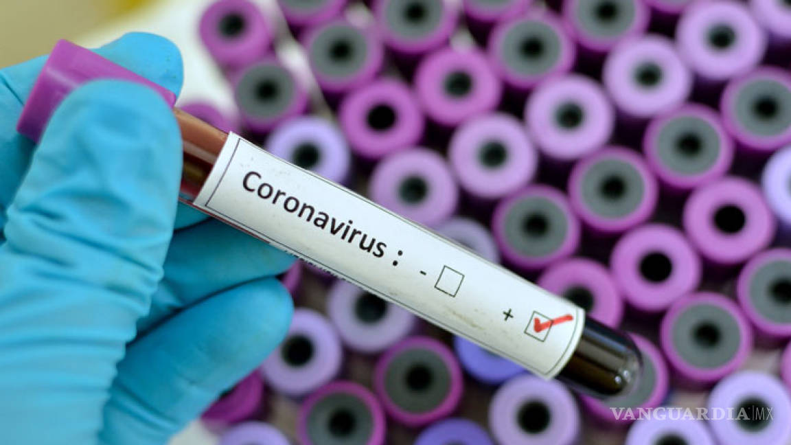 Reportan primer fallecimiento por coronavirus de un mexicano: José Kuri Harfush, empresario cercano a Carlos Slim