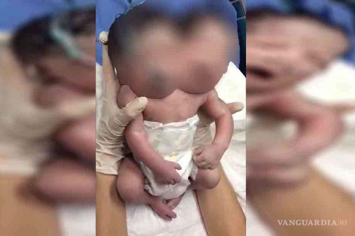 Reportan presunto nacimiento de bebé con dos cabezas en Ciudad Juárez