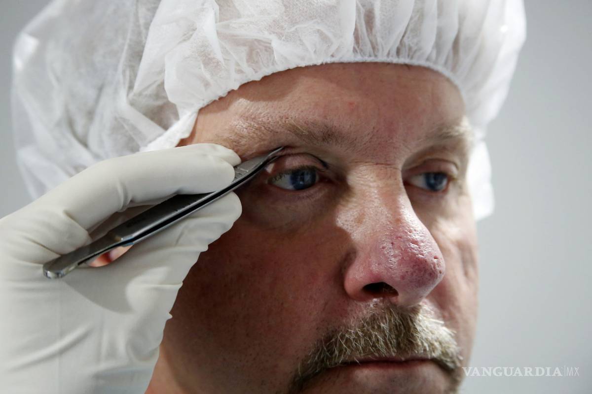 Fenómeno “incel”, la evolución en la cirugía estética masculina