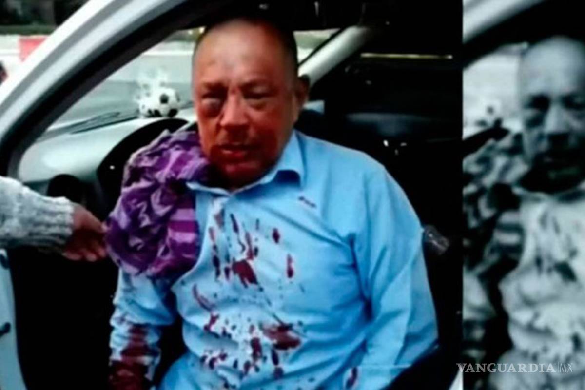 Taxista muere tras ser golpeado brutalmente por pasajeros, no querían pagar