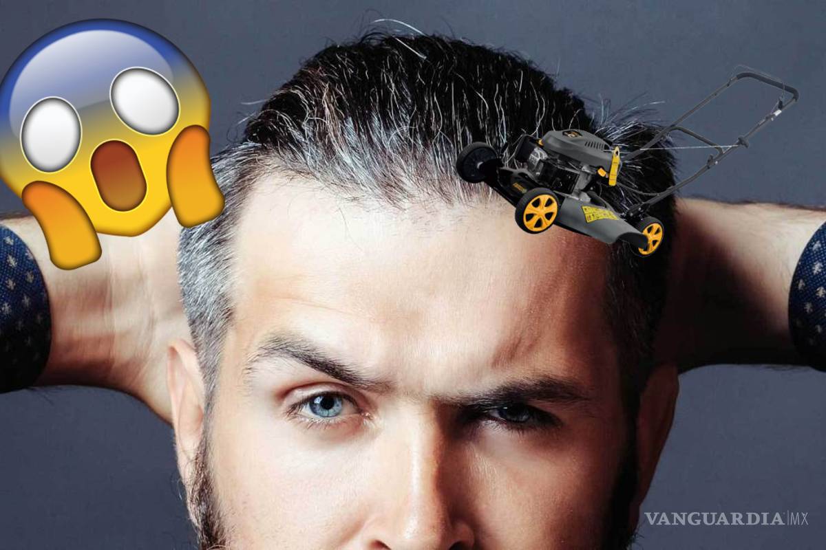 Calvicie: el terror en la 'azotea' que nadie quiere experimentar