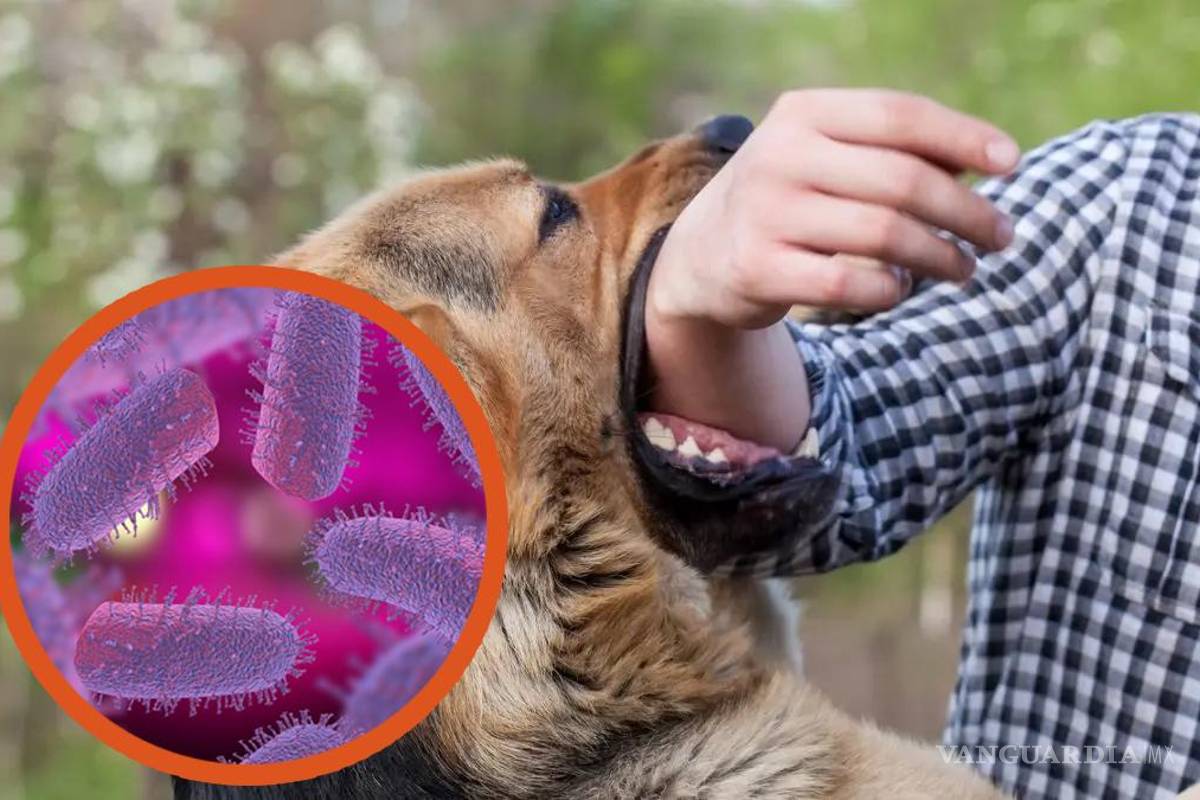 ¿Qué pasa si te muerde un perro con rabia?... qué tan grave es y qué medidas debo tomar