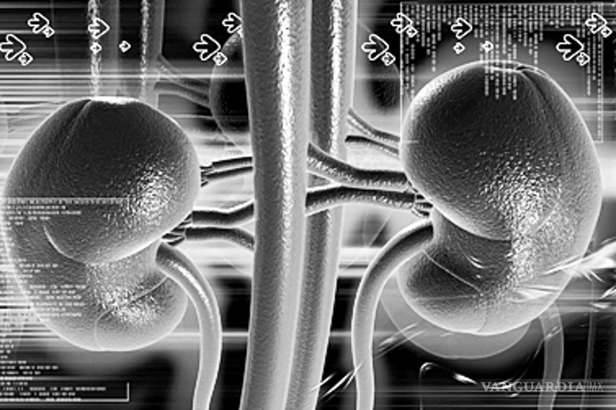 Quistes en el riñón, la causa más frecuente