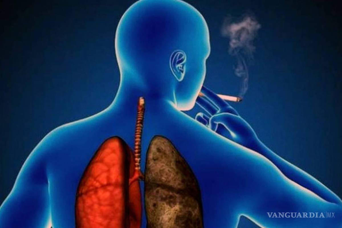 Cáncer de pulmón, con una letalidad del 95 por ciento en Coahuila