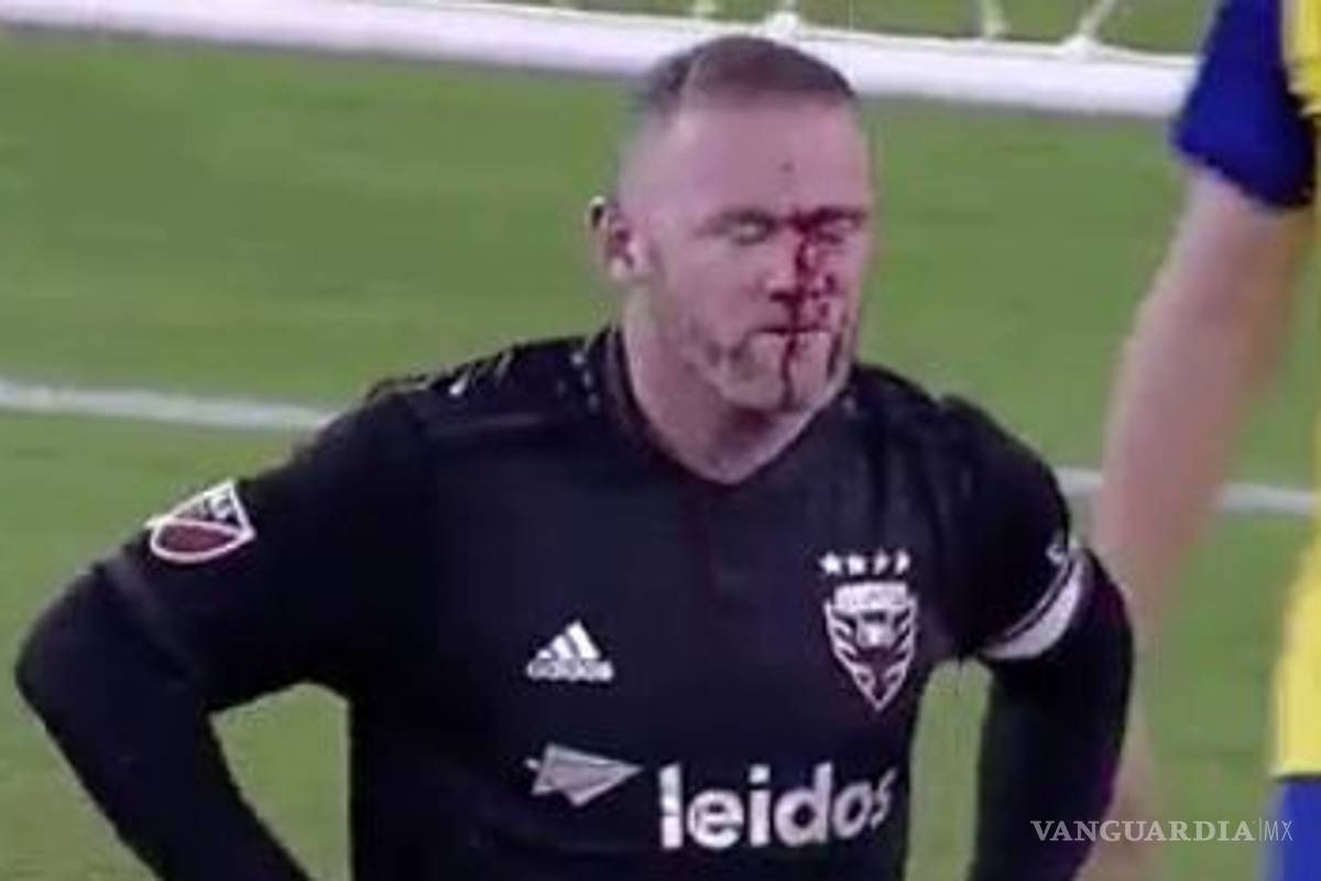 Rooney anota su primer gol en la MLS pero le cuesta sudor y sangre... mucha sangre