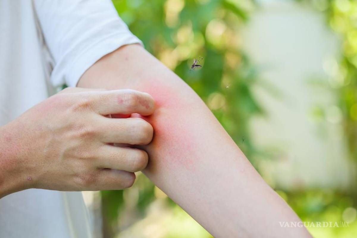 Región Centro suma 74 contagios de dengue y refuerza prevención