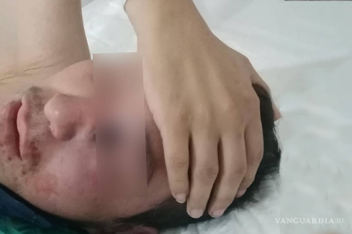 Gregorio perderá el ojo izquierdo por 'hongo negro'; infección ligada al covid-19