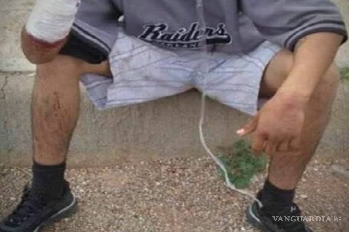 Por ladrón le cortan la mano a joven de 16 años