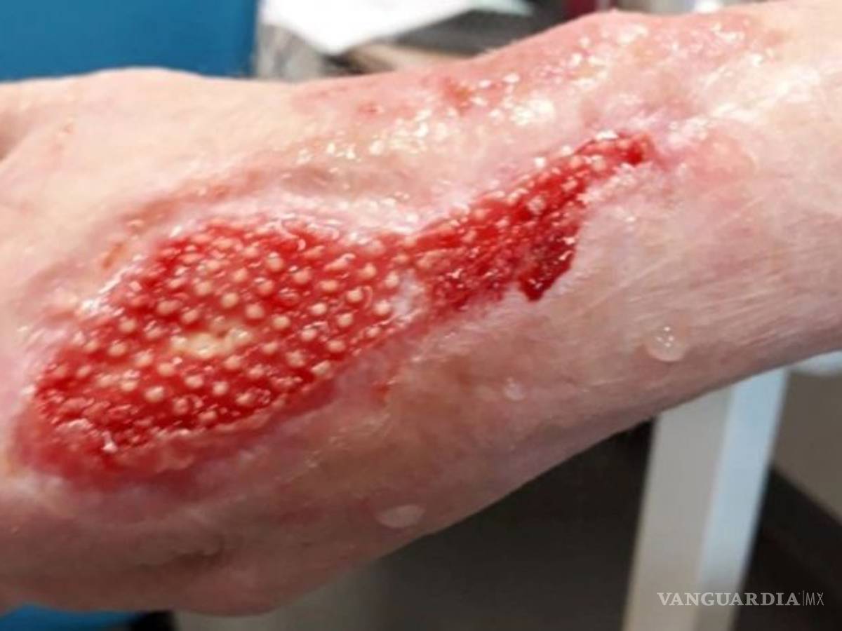 $!Una mujer estuvo entre la vida y la muerte por un arañazo de su gato