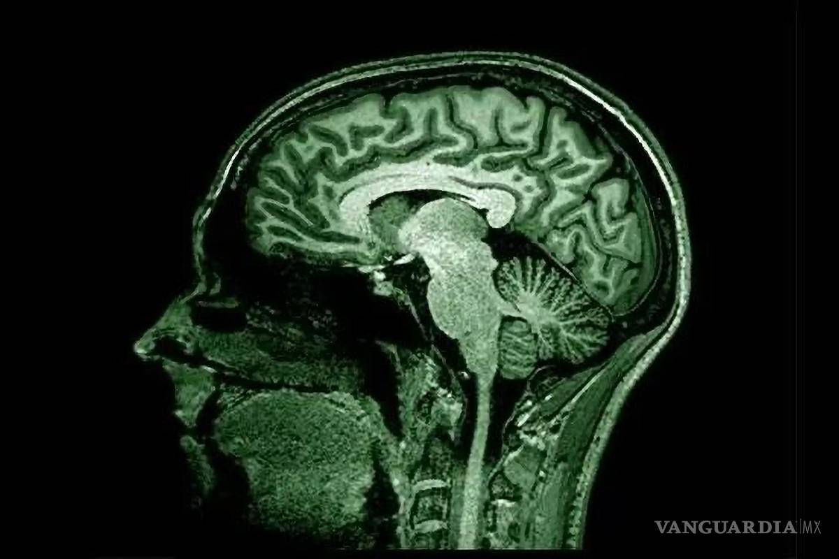 Da la ciencia un gran paso al descifrar el mapa proteico de la neurodegeneración