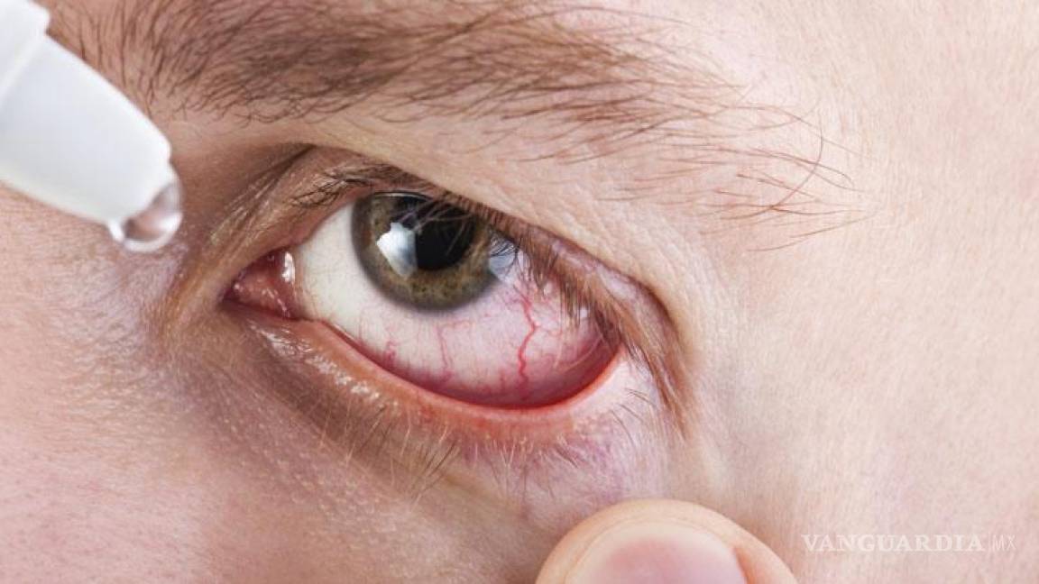 Más de la mitad de mexicanos padecen el síndrome del ojo seco