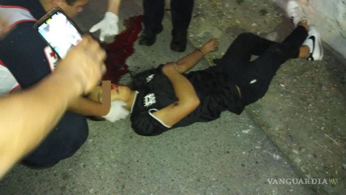 Menor pierde la vida por balazo en la cabeza en Torreón