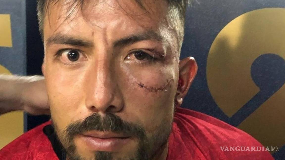 Así fue el brutal golpe que recibió el portero de los Pumas en Copa MX
