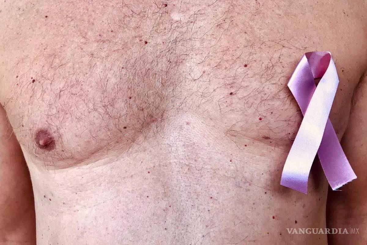 Cáncer de mama también alcanza a hombres: reportan siete casos en Coahuila