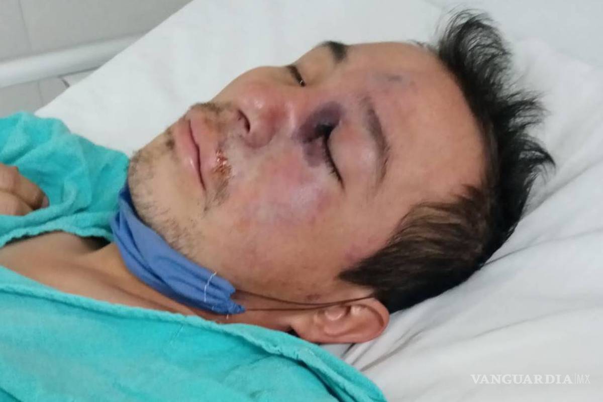 Descarta IMSS confirmar primer caso de “Hongo Negro” en México, esperan conocer diagnóstico