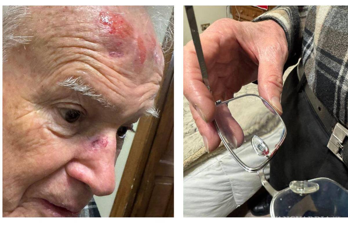 Obispo emérito Raúl Vera sufre caída en el Centro de Saltillo y comparte imágenes de sus heridas en redes