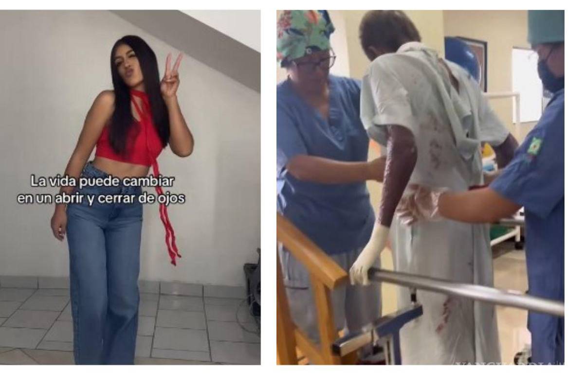 Un año después de la explosión, joven de Saltillo narra su lucha por sobrevivir