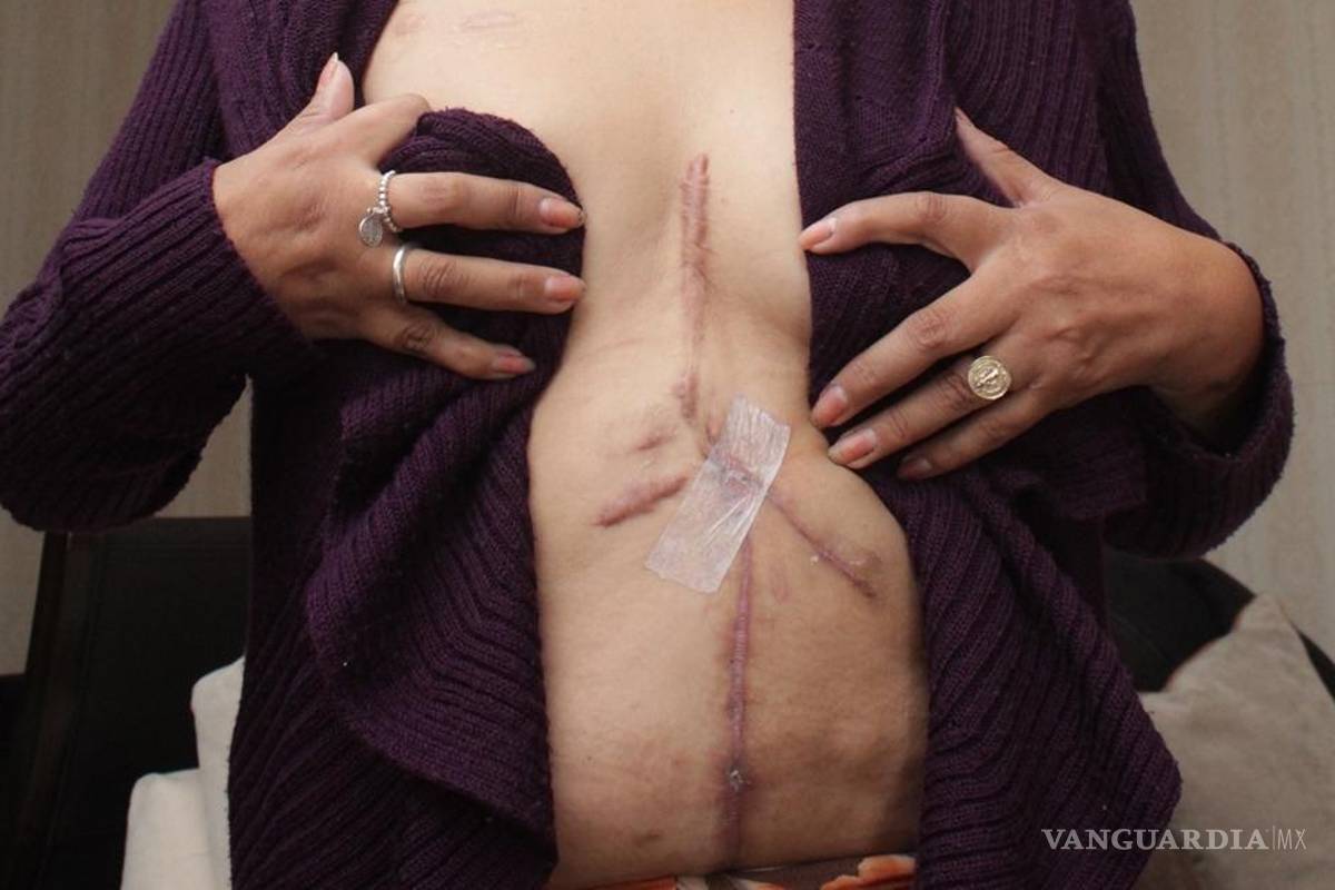 $!Violencia de género: Angélica sobrevive a 37 puñaladas