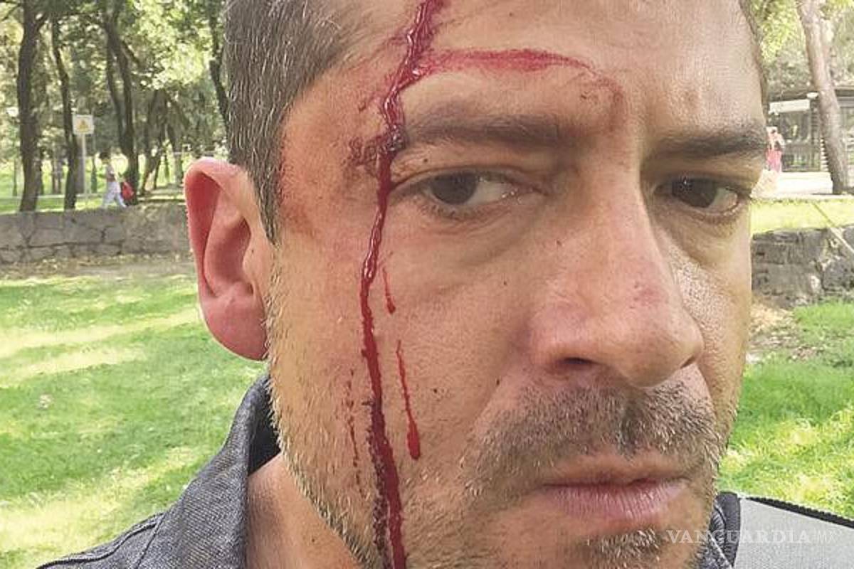 Vendedores de droga golpean a periodista en Ciudad Universitaria de la UNAM