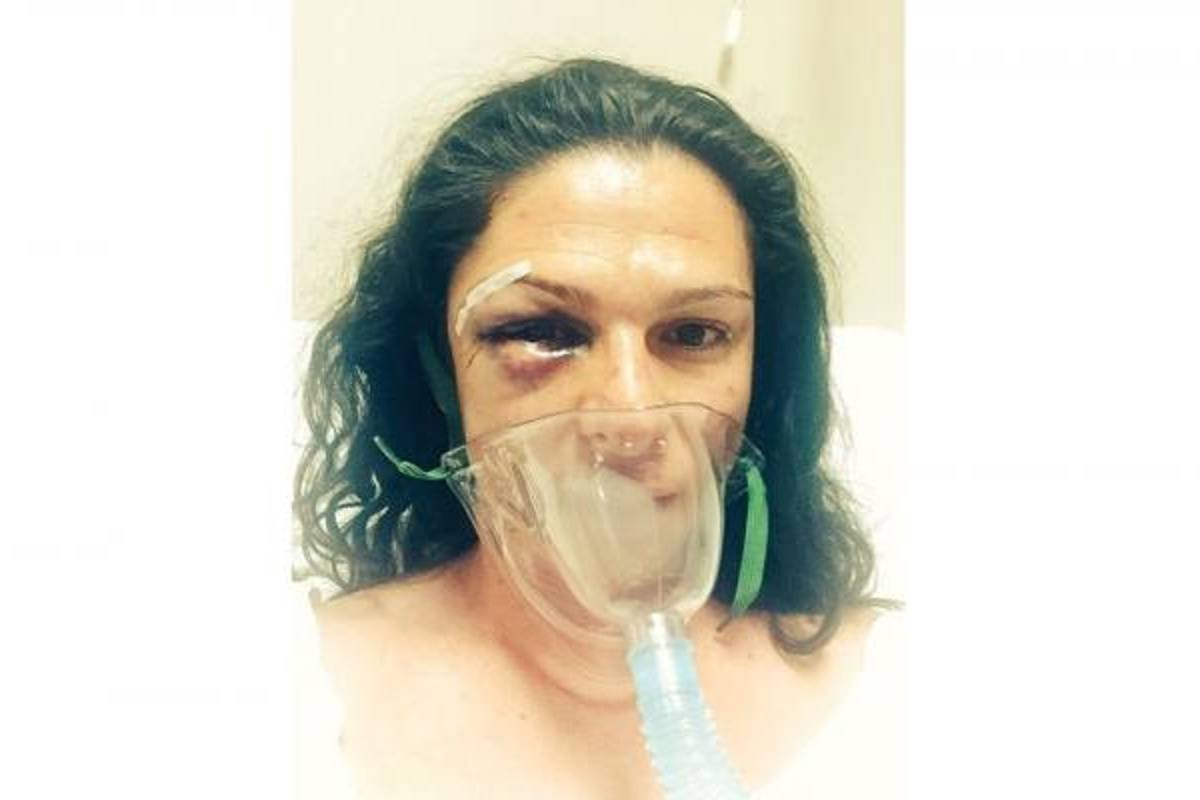 Ana Guevara habla sobre su agresión; PGR investiga