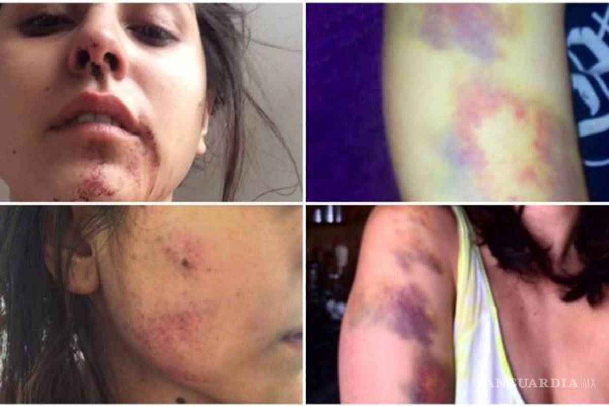 Modelo denuncia brutal golpiza por parte de guitarrista