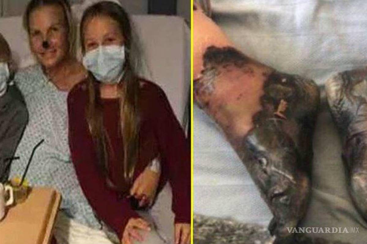 Le diagnosticaron asma, pero terminaron amputándole piernas y mano