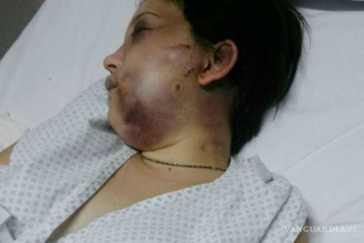 Normalidad dispara agresiones a mujeres en México