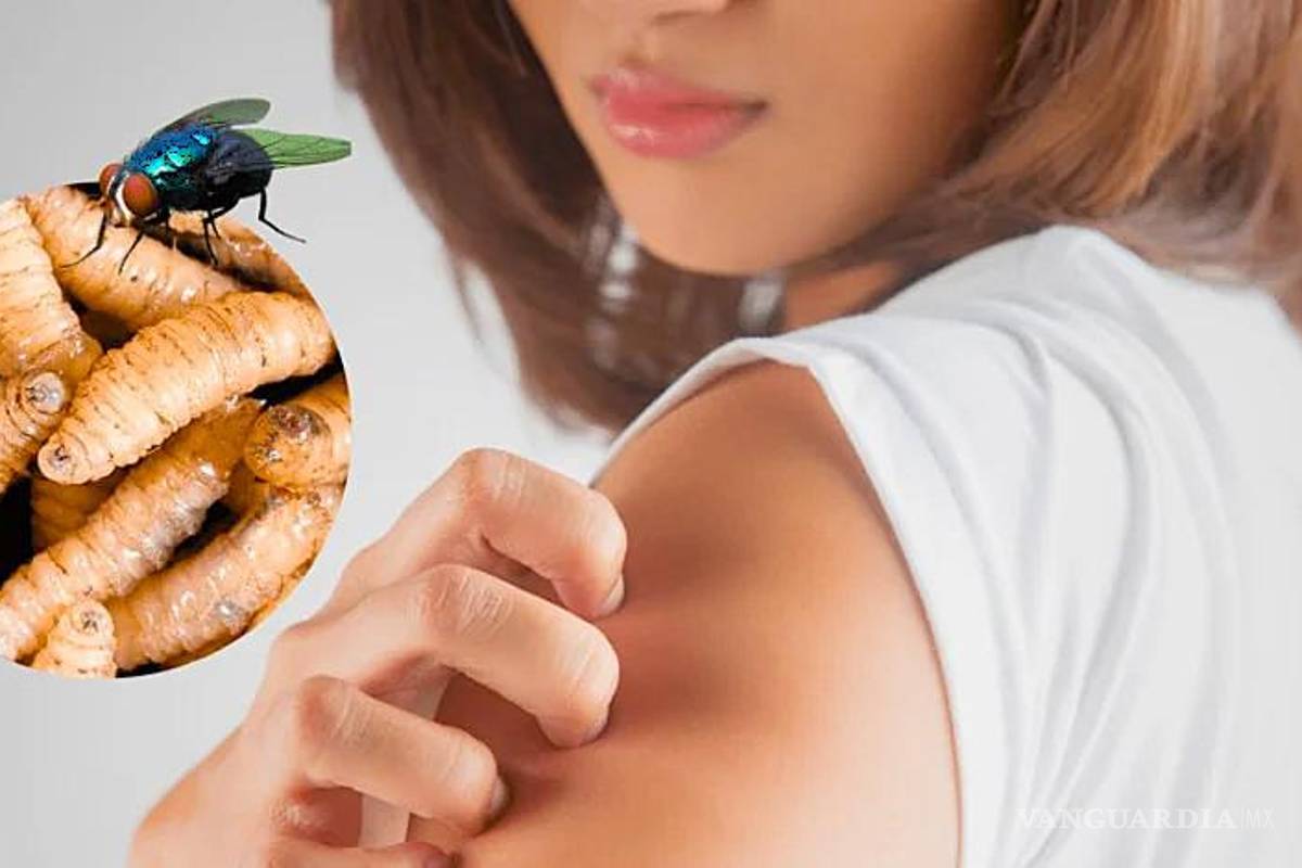 Pide el Congreso de Coahuila al Senasica reforzar su capacitación para prevenir la miasis por gusano barrenador en humanos