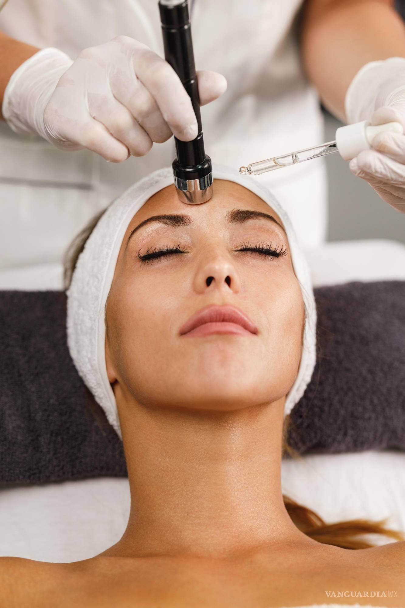 Mitos y verdades del microneedling en la medicina estética 