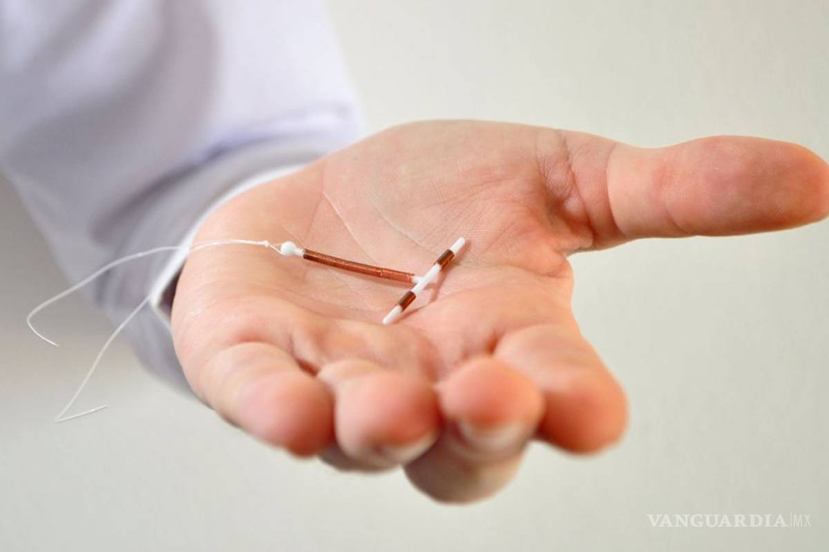 Todo lo que necesitas saber sobre el DIU (Dispositivo Intrauterino)