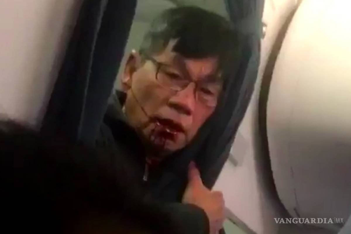 David Dao, pasajero de United Airlines, necesita cirugía reconstructiva dice su abogado