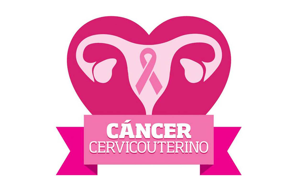 Científicos mexicanos trabajan nueva terapia contra cáncer cervicouterino