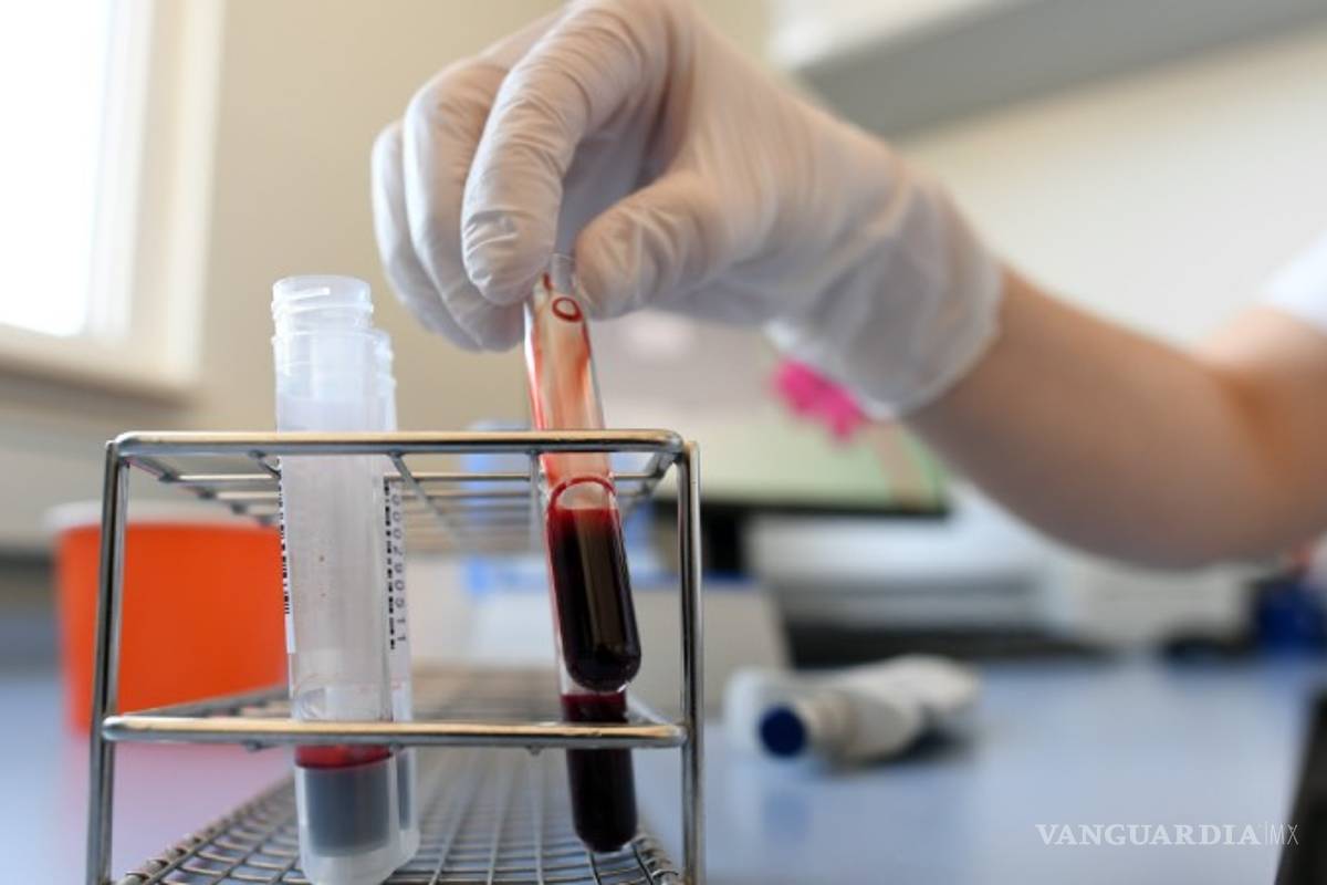 Verificado: El tratamiento con plasma para coronavirus COVID-19 es todavía un estudio clínico