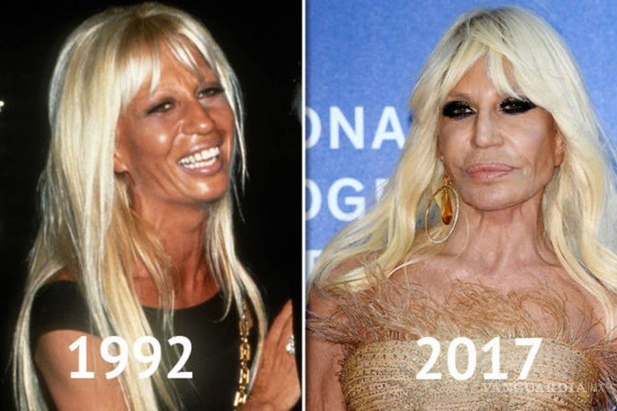 $!¿Una cirugía más? Axl Rose y Mickey Rourke lucen irreconocibles