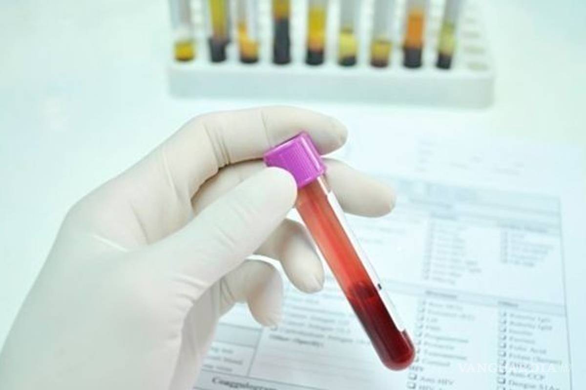 COVID-19 es ‘particularmente atraído’ por el grupo sanguíneo A