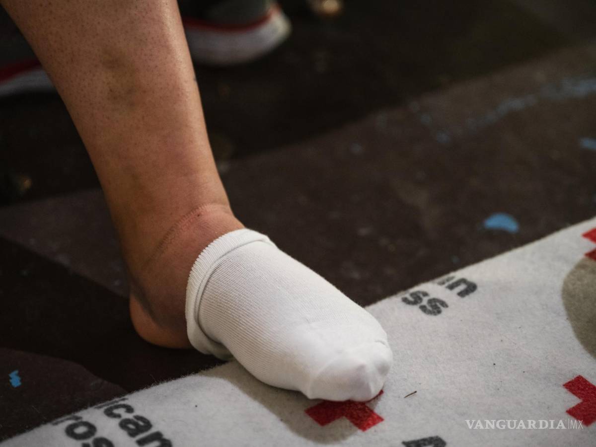 $!El pie de Rosmarie Cepeda, que se rompió al caer mientras descendía del muro fronterizo en El Paso, Texas.