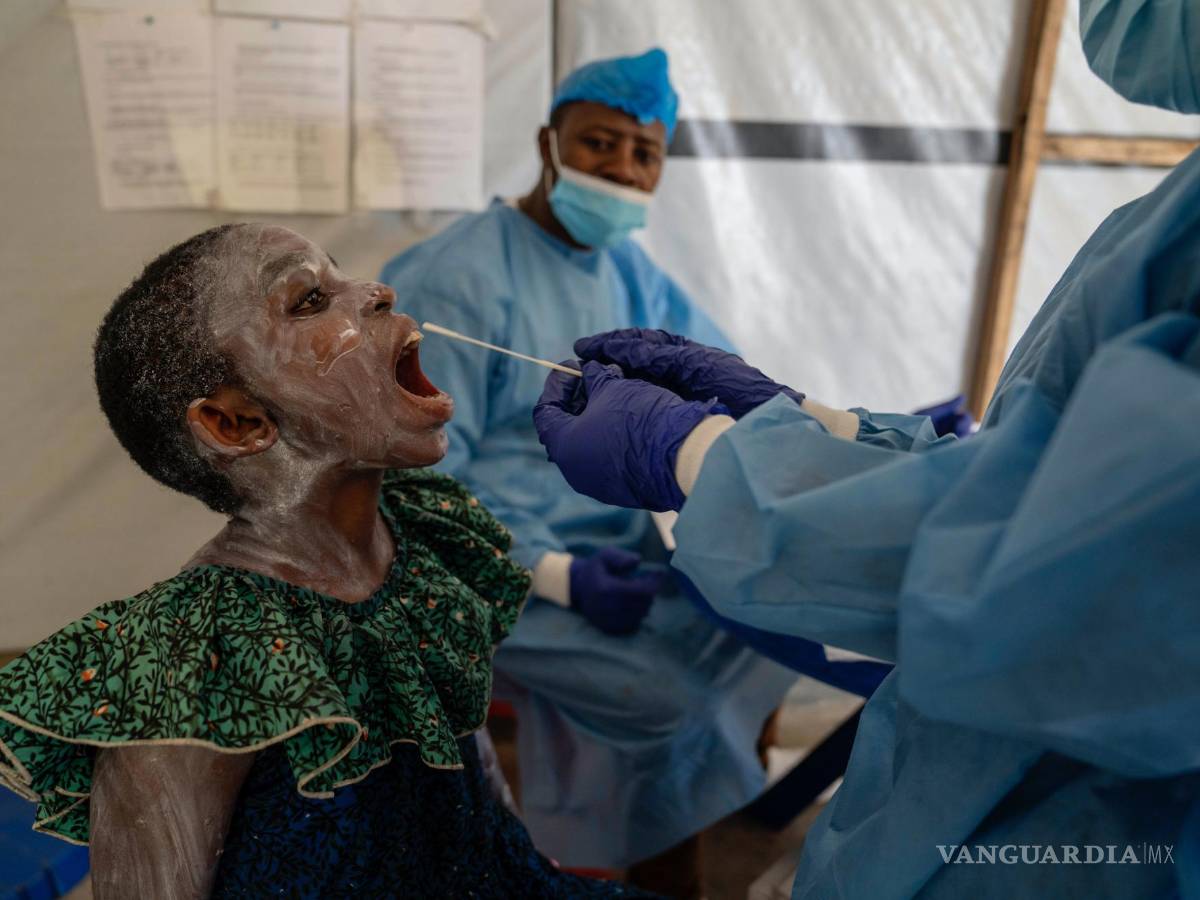 $!Un trabajador sanitario toma una muestra de saliva a Lucie Habimana, de 13 años con viruela símica, en un centro de tratamiento en Munigi.