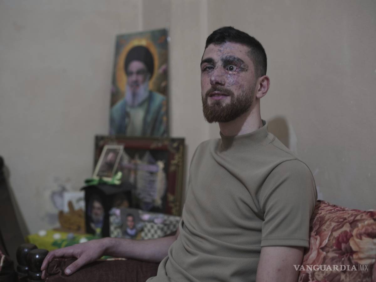 $!Mahdi Sheri, de 23 años, quien resultó herido en el ataque con bípers contra Hezbollah el 17 de septiembre de 2024 en el suburbi de Burj al-Barajneh, Líbano.