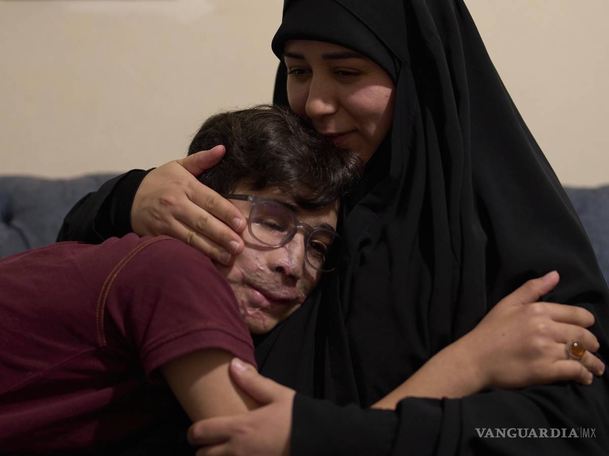 $!Hussein Dheini, de 12 años, herido en el ataque con bípers, recibe consuelo de su madre, Faten Haidar, en su casa en la aldea de Teir Debba, en el sur del Líbano.